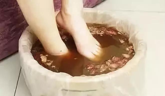 骨伤科熏洗的关注事项,骨伤用药有哪些