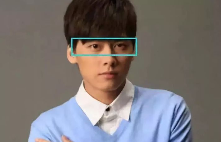 一单一双眼皮就不对称,左右眼皮不对称一单一双叫什么