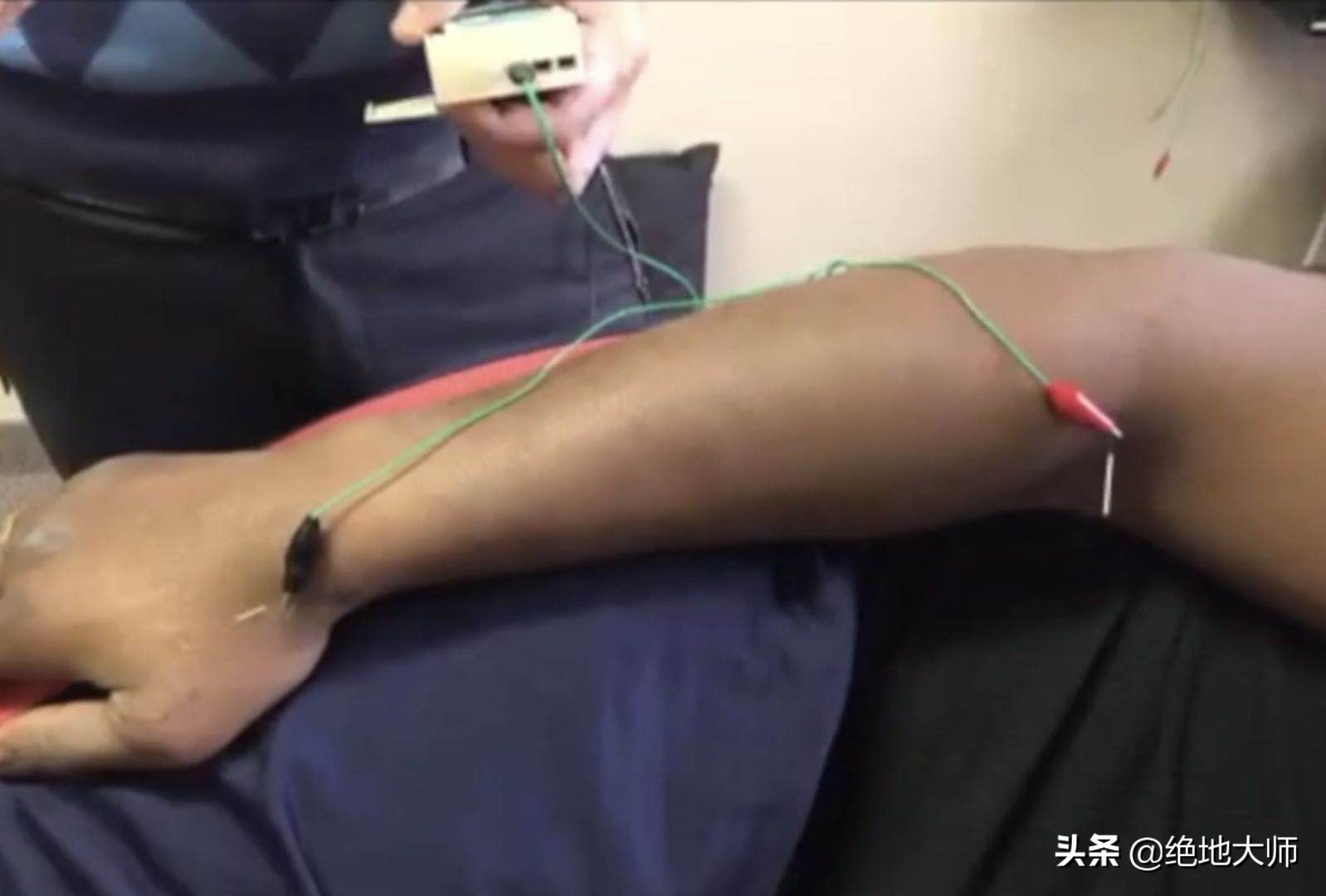 皮神经自愈方法,皮神经调控康复方法