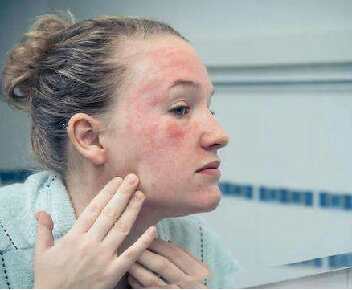 春天皮肤敏感泛红刺痛要怎么护肤,春季皮肤过敏泛红怎么护肤