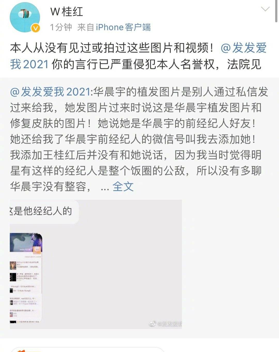 华晨宇整容事件大反转拒绝道歉