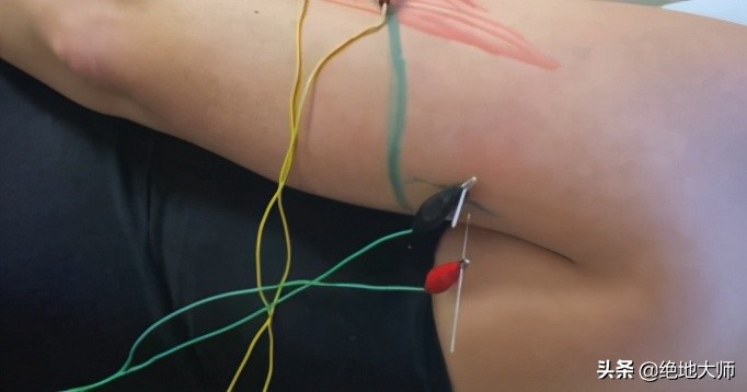 手神经外伤康复视频,治疗手神经损伤的药