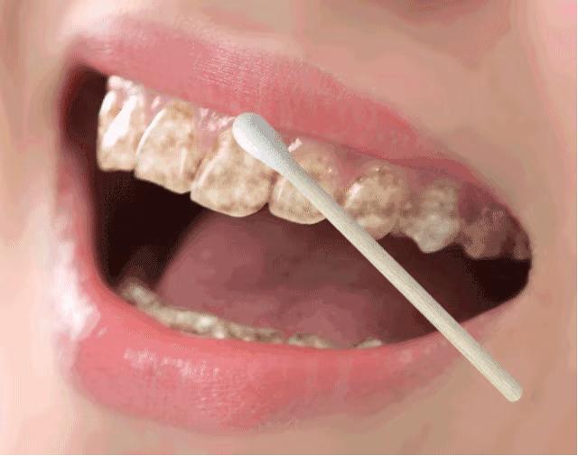 专治牙黄口臭的小窍门,牙黄口臭用什么牌子牙膏刷牙最好