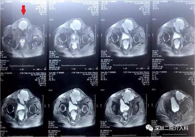 冰雕细琢流光溢彩,冰雕刺身雕刻