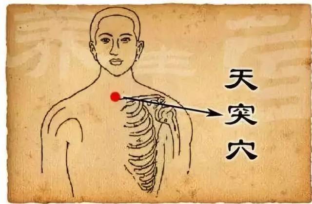 慢性咽炎、喉咙红肿、咽喉肿痛用什么药？