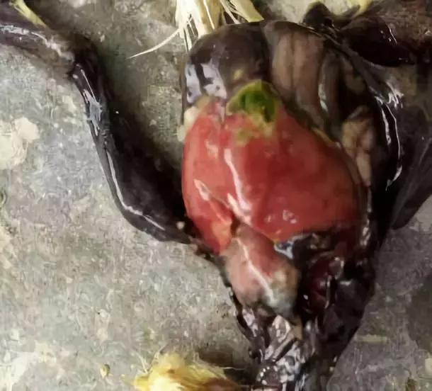 “五颜六色”的粪便背后隐藏着什么？又和肝脏疾病有怎样的联系呢