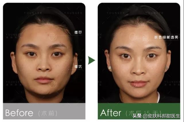 漾格医疗美容怎么样,漾格医美怎么样