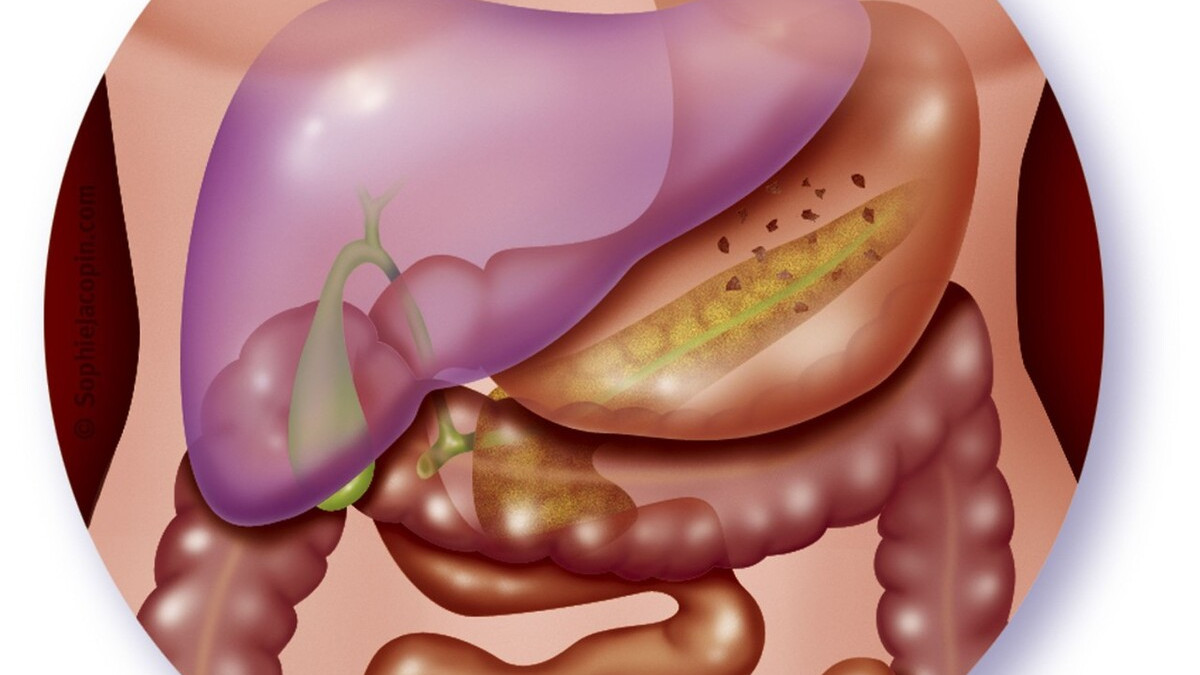 中午吃饱了就犯困要不要睡,为什么中午吃饱睡觉醒了很难受