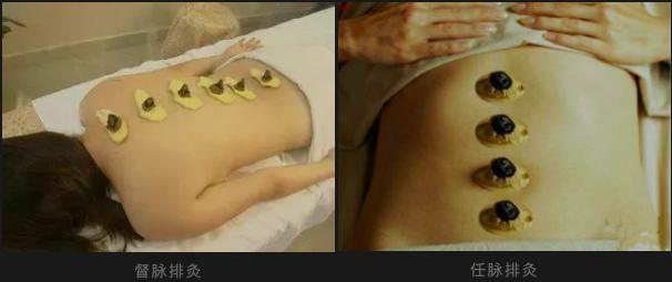 仙游县医院三伏贴预约,仙游县中医理疗馆