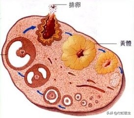 搬个东西就“黄体破裂”了？妇科医生说出真相