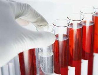 pct异常升高常见哪些疾病,pct突然升高