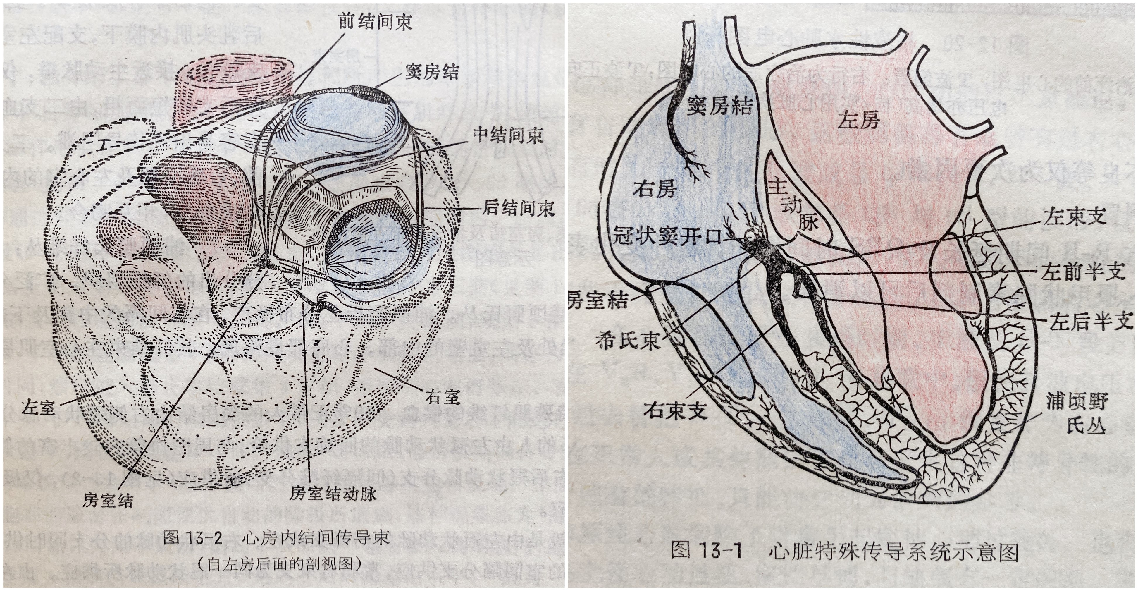 心电图看出什么堵塞,心电图查出右束支阻滞