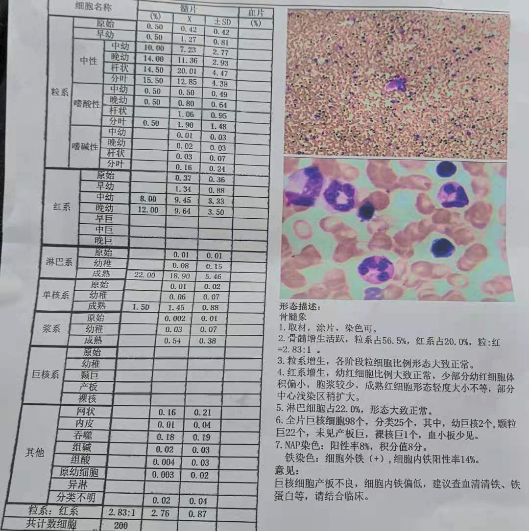 是谁揭开了血小板减少的面纱？