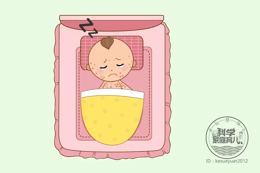 每个孩子都要起疹子吗,小孩起疹子最快的解决办法