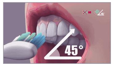 接吻时有生理反应？更尴尬的是牙黄还有口臭好吗…