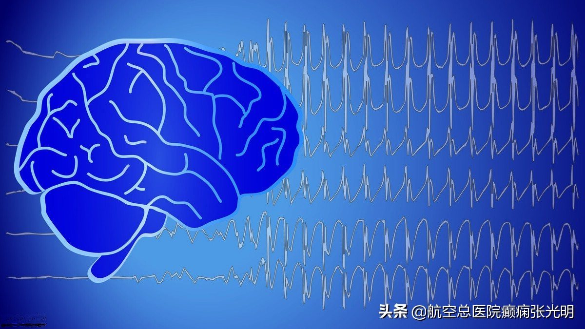 张光明癫痫病视频,张光明癫痫