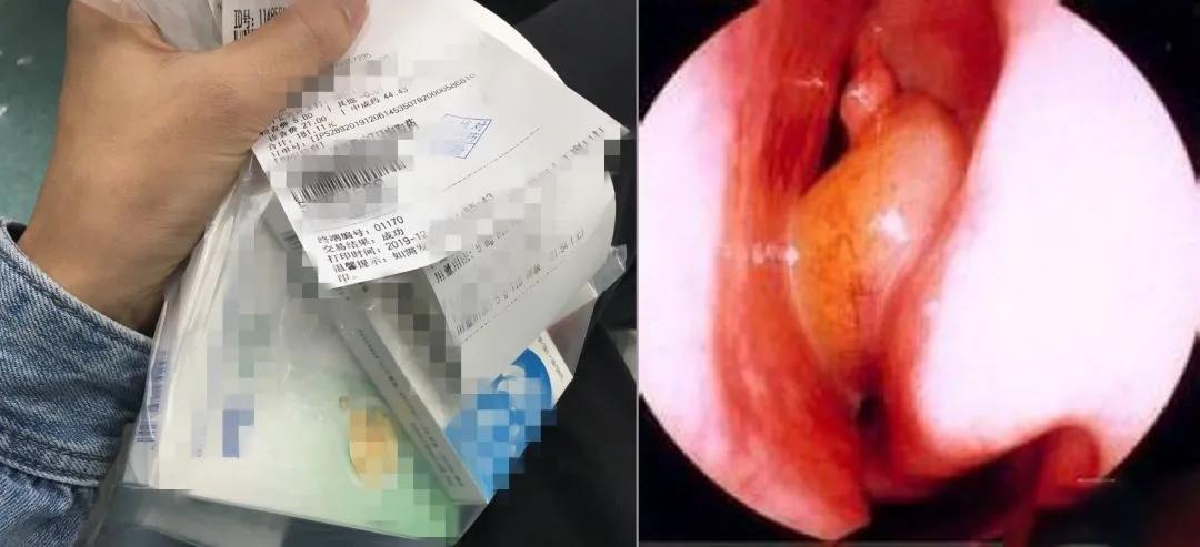 空调房鼻子痒打喷嚏怎么回事,夏季吹空调鼻子痒的原因