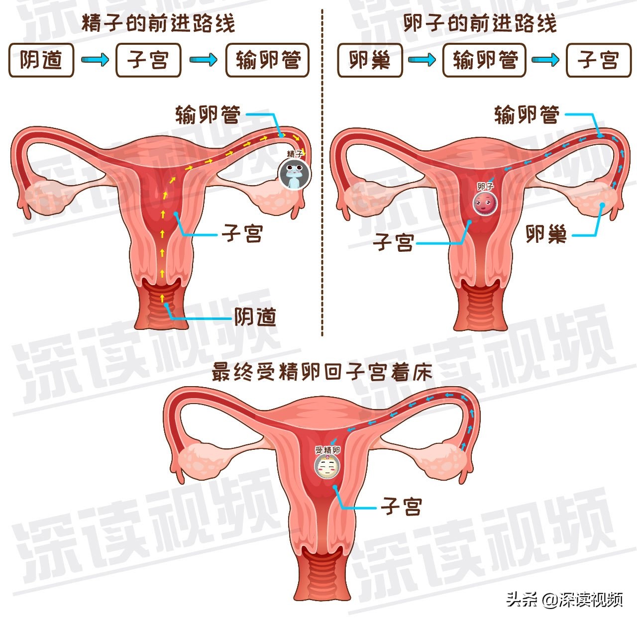 受精卵缘何子宫外安家？是输卵管不通？还是炎症、肿瘤在作妖？