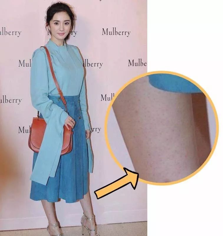 花几千块钱去美容院治痘会好吗,花了数万元购买医美项目