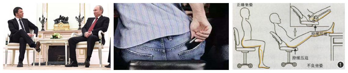 屁股痛、腿麻，有块肌肉受伤了