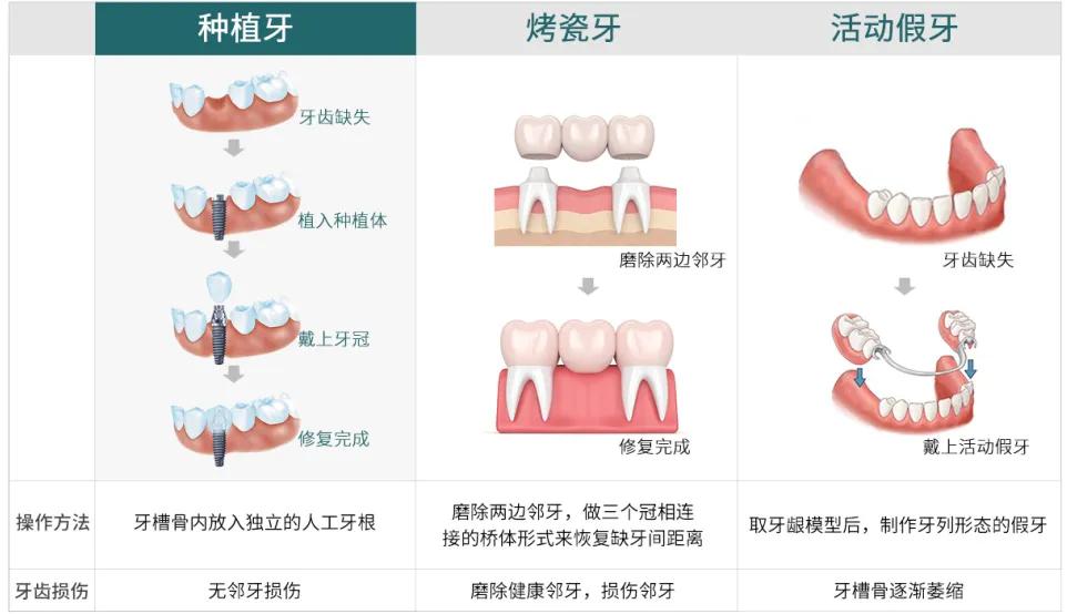 假牙吃到肚子里有什么坏处,把假牙吃到肚子的急救办法