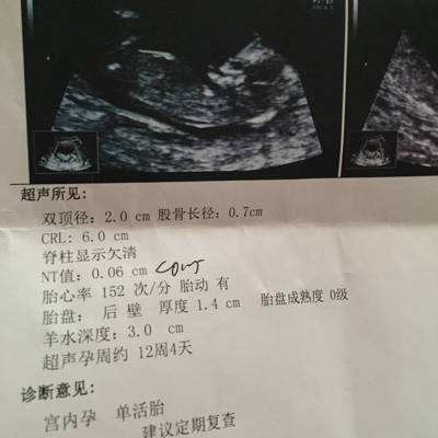怀孕初期关注事项及产检报告指标,孕早期关注事项视频