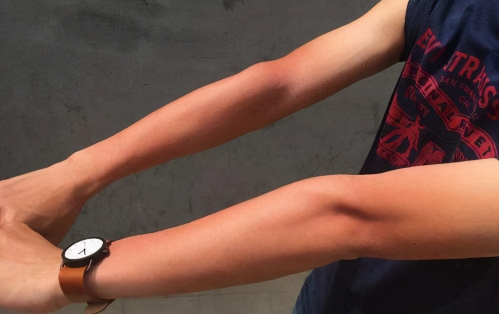 为什么别人晒不黑我一晒就黑,为什么你一晒就黑了