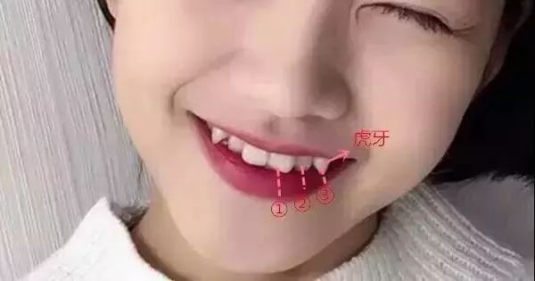 虎牙齿能不能拔,老虎牙可以拔掉吗