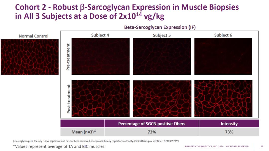 fda批准细胞治疗,fda批准治疗als的药物