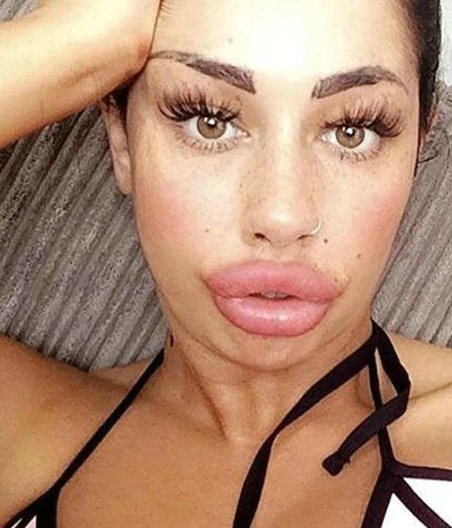 人造女人漂亮吗,人造嘟嘟嘴唇