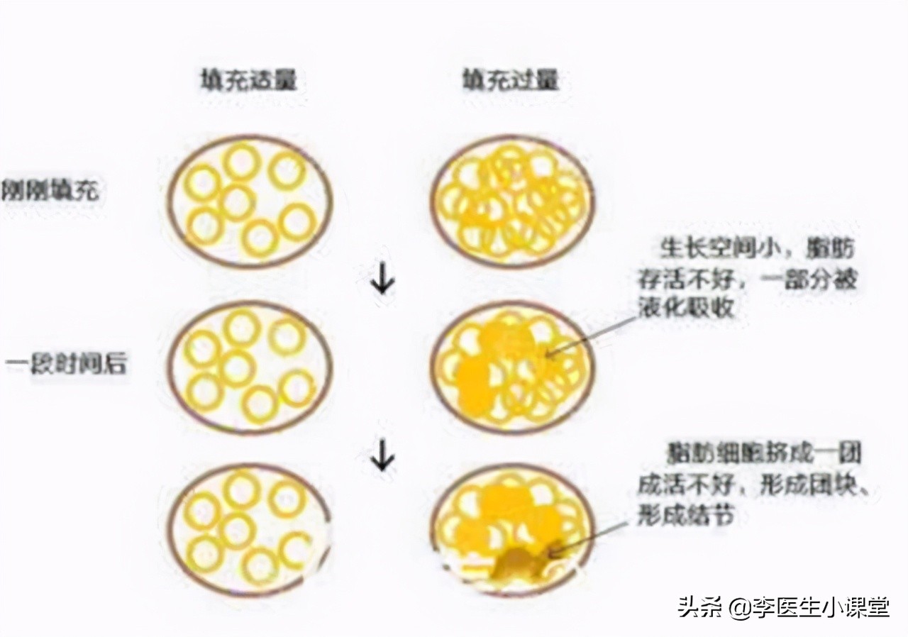 肛门周围总是潮湿瘙痒，是什么疾病？医生告诉你应该怎么治疗？