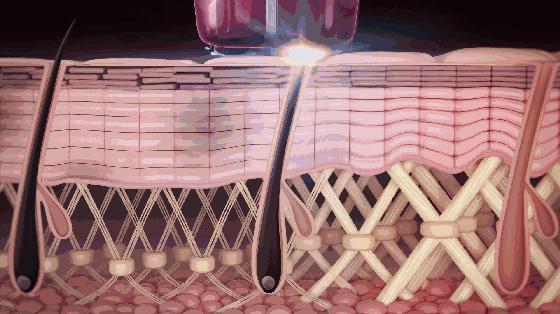 脱毛仪夏日变美的必备,脱毛效果最好的家用脱毛仪