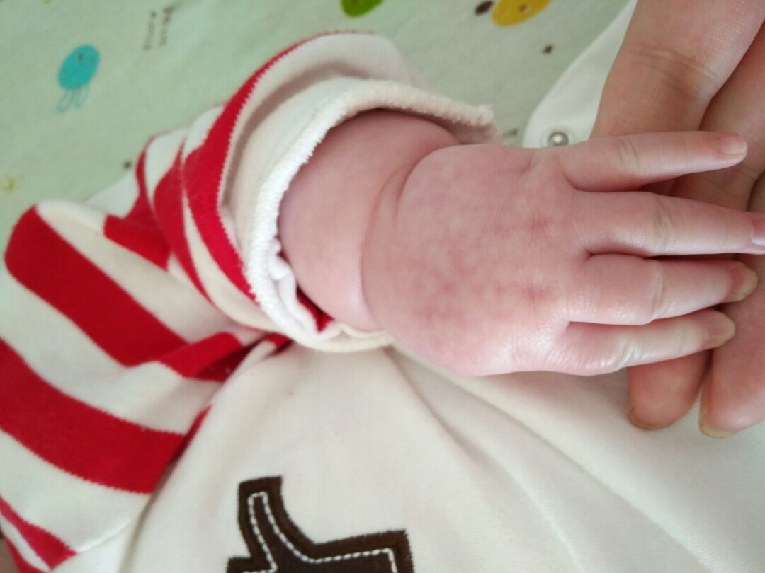 夏天怕冷不能吹空调中医怎么调理,冬天手脚冰冷怎么办最有效方法