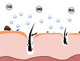 黑头反复怎么办一招教你去黑头,还在为黑头烦恼一招教你祛黑头