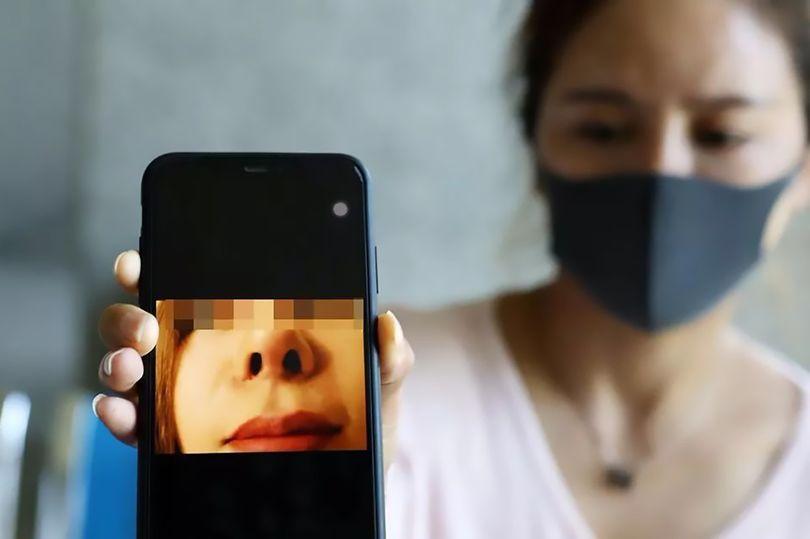 一女子整容成熊猫鼻,泰国妹子花150万整容