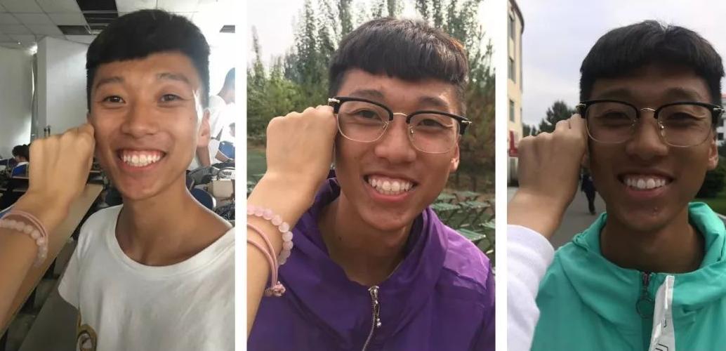 皮肤黑怎么变白立马见效,皮肤暗黑怎么变白小妙招