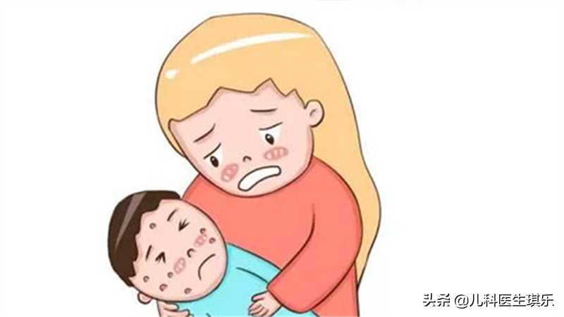 宝宝长水痘怎么治疗要关注哪些,宝宝长水痘一定要关注什么