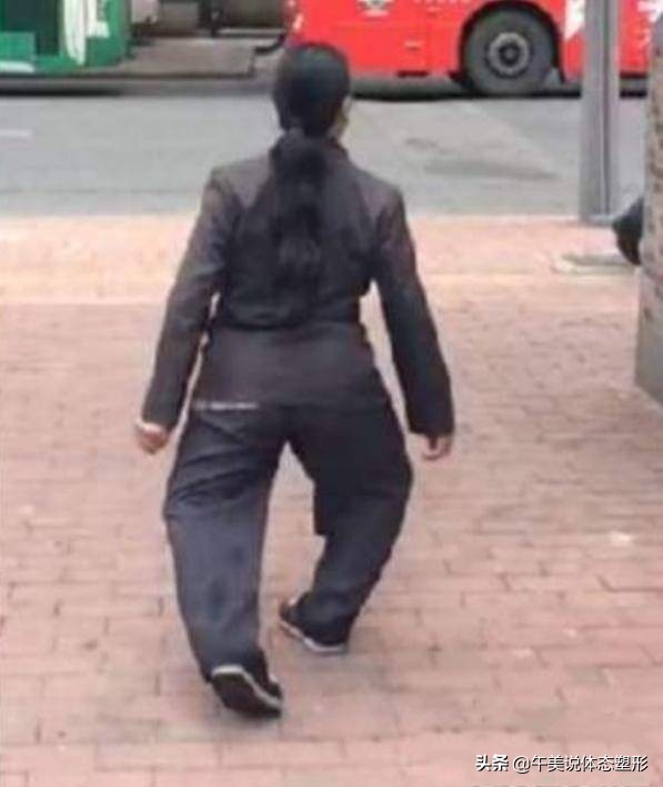 膝盖下o型腿怎么矫正,膝盖腿弯疼最好治疗方法