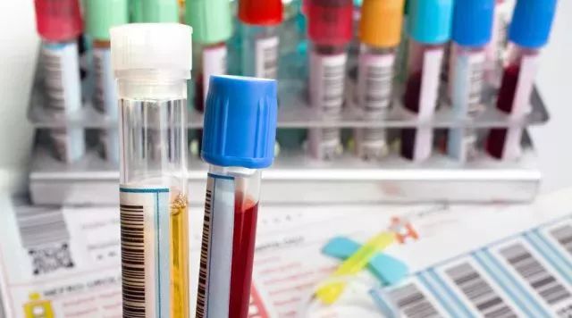 清风计划三级检查,健康体检需要清风计划吗