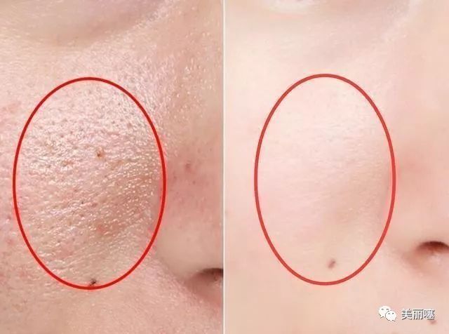 微商的大牌化妆品为什么那么便宜,微商卖的大牌化妆品为什么便宜