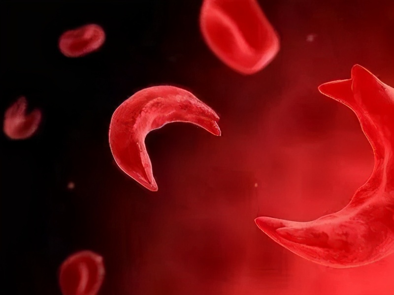 胆红素偏高的原因及危害怎么办,胆红素升高了是怎么回事