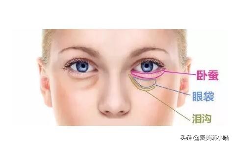 一张图分清散光和近视,眼袋和卧蚕的区分方法