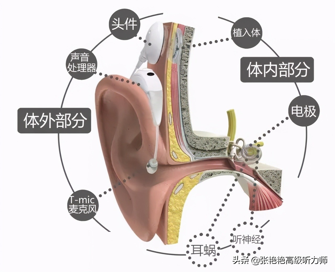 听力不好应该看什么科,听力不好选什么耳机