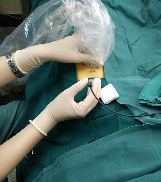 糖尿病神经痛能打封闭针吗,糖尿病神经痛的药