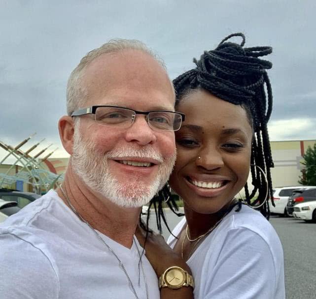 26岁女子治疗脱发,尿液治脱发