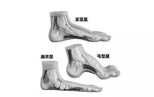 练就笔直大长腿，OX腿型如何应对？！｜运动康复003课