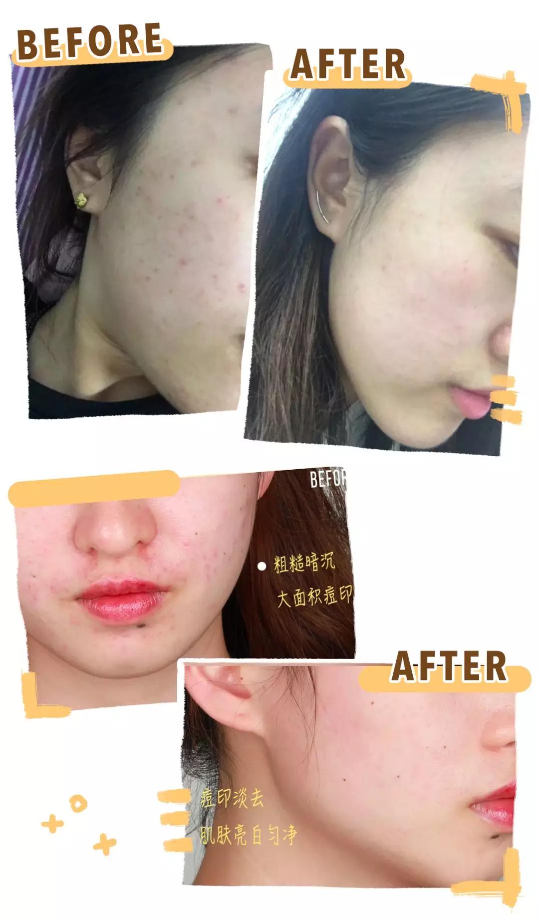 70块钱买一个皮肤值得吗,70块钱买什么皮肤