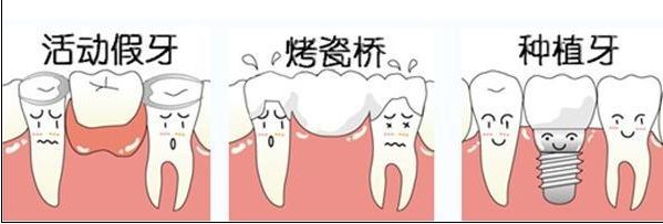 装了假牙以后还会蛀牙吗,装了假牙后可以取下来重头装吗