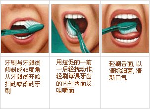 预防牙龈出血的牙膏,牙龈出血该怎么预防