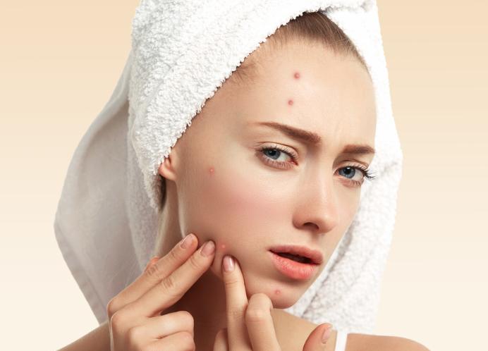 下巴和鼻翼白色的小粉刺,鼻子下巴白色粉刺